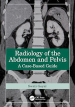 Cover of Radiology of the Abdomen and Pelvis: A Case-Based Guide