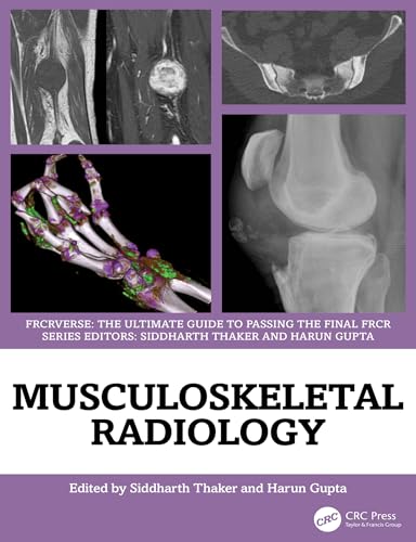 Cover of Musculoskeletal Radiology: An Ultimate Guide to Passing the Final FRCR (FRCRverse)