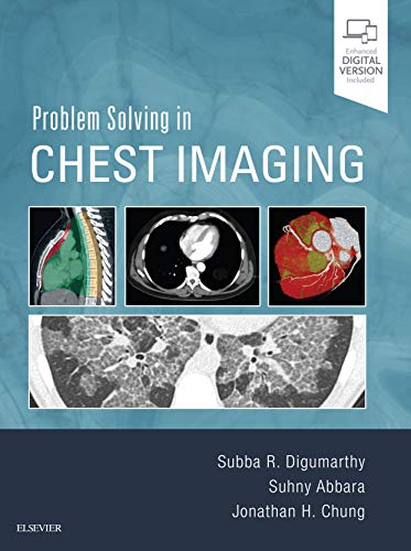 Cover of Problem Solving in Chest Imaging