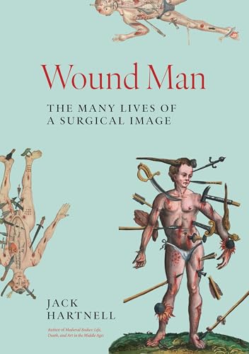 Cover of Wound Man: The Many Lives of a Surgical Image