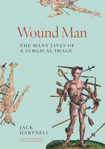 Cover of Wound Man: The Many Lives of a Surgical Image