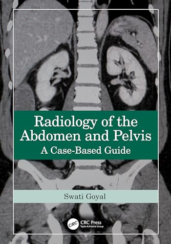 Cover of Radiology of the Abdomen and Pelvis: A Case-Based Guide