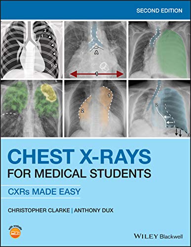 Cover of Chest X-Rays for Medical Students: CXRs Made Easy