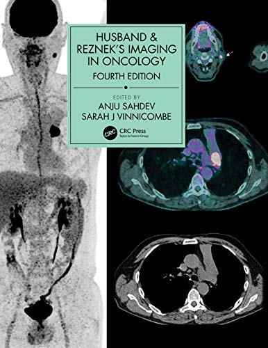 Cover of Husband & Reznek's Imaging in Oncology