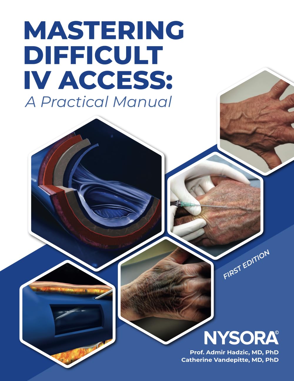 Mastering Difficult IV Access - a Practical Manual: First Edition (Nursing)