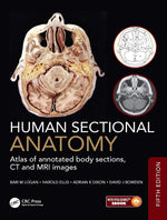 Human Sectional Anatomy: Atlas of annotated body sections, CT and MRI images