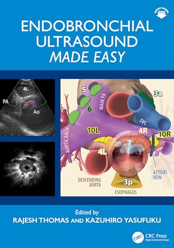 Cover of Endobronchial Ultrasound Made Easy